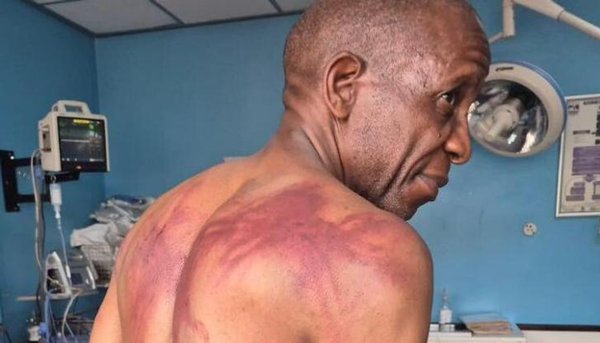 The message: Resist 2030 and we will beat you up