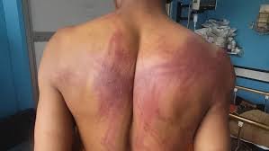 ZPP Raises Alarm Over Surge in Rights Violations Across Zimbabwe